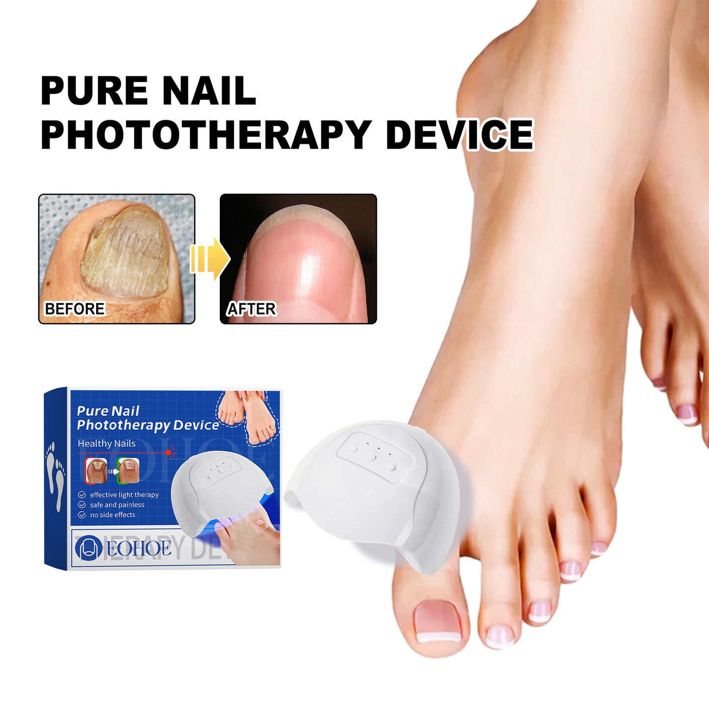 NailRepair™