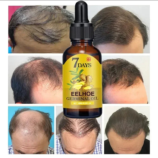 OUHOE Anti-Hair Loss Growth Serum