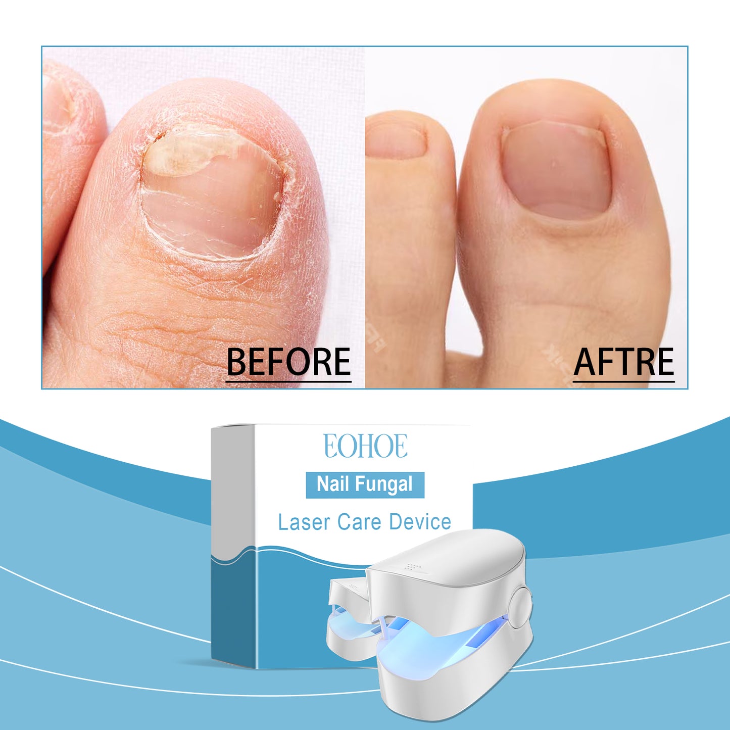 NailFix™