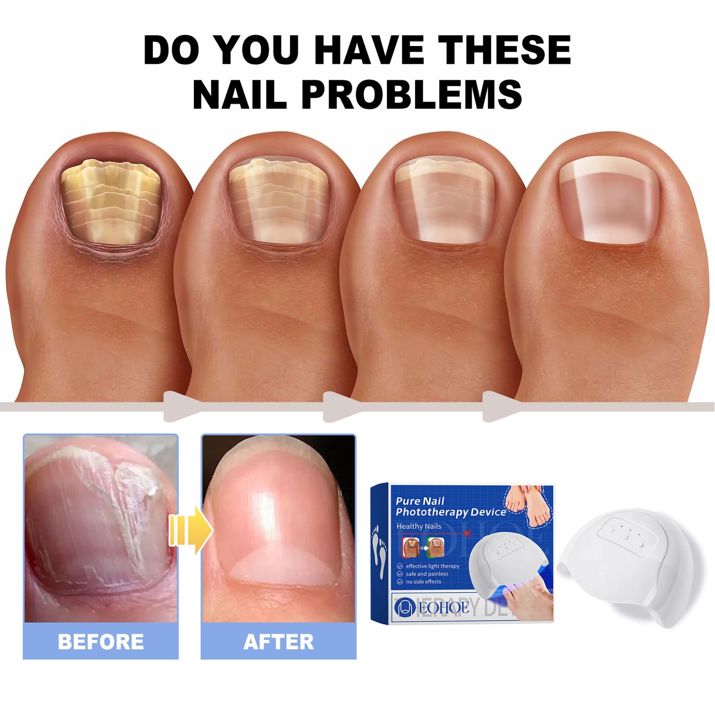 NailRepair™