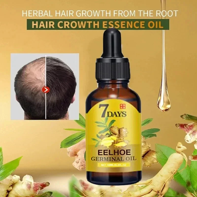 OUHOE Anti-Hair Loss Growth Serum