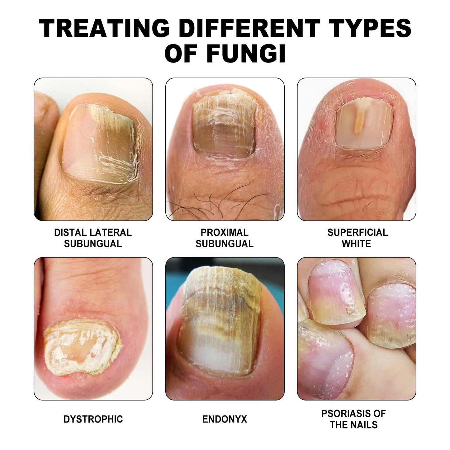 NailRepair™